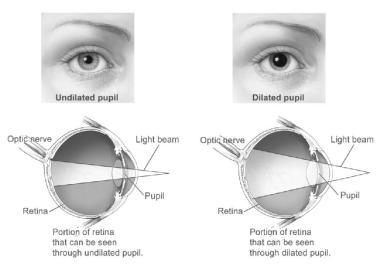 graphic depicting impact of eye dilation